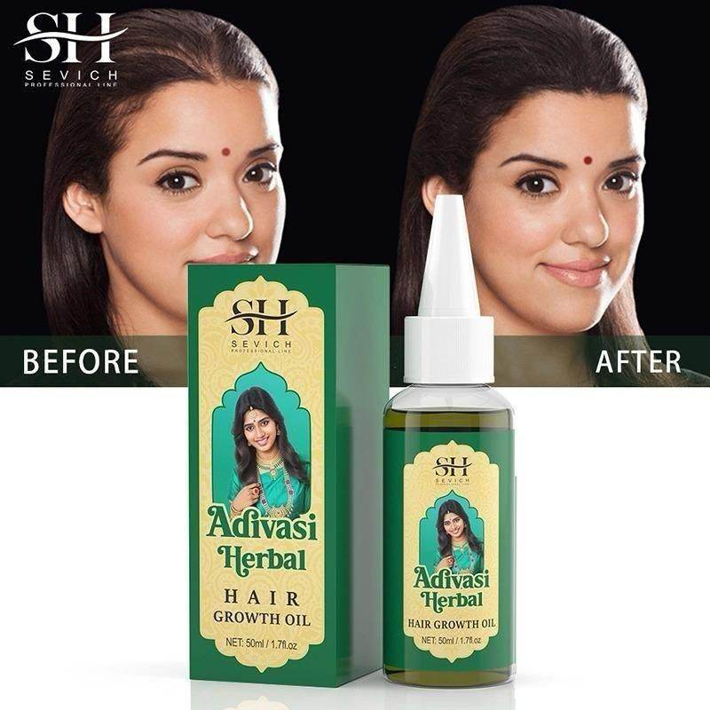 SH Adivasi Hernal Hair Growth Oil 60ml - Nourish Your Roots Naturally (Pack of 2) - NARIX INDIA 