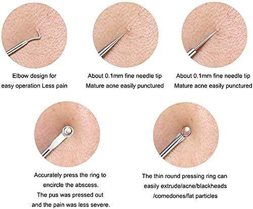 Stainless Steel Blackhead Remover Extractor Tool Set of 4 - NARIX INDIA 