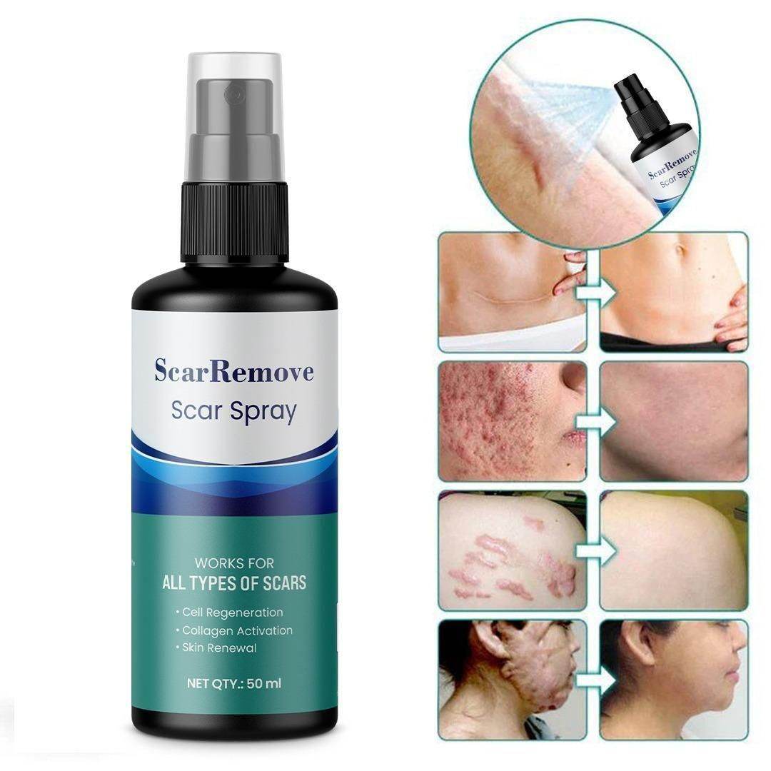Scar Removal Spray 50ml	Pack Of 2 - NARIX INDIA 