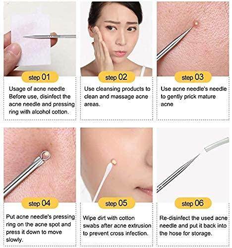 Stainless Steel Blackhead Remover Extractor Tool Set of 4 - NARIX INDIA 