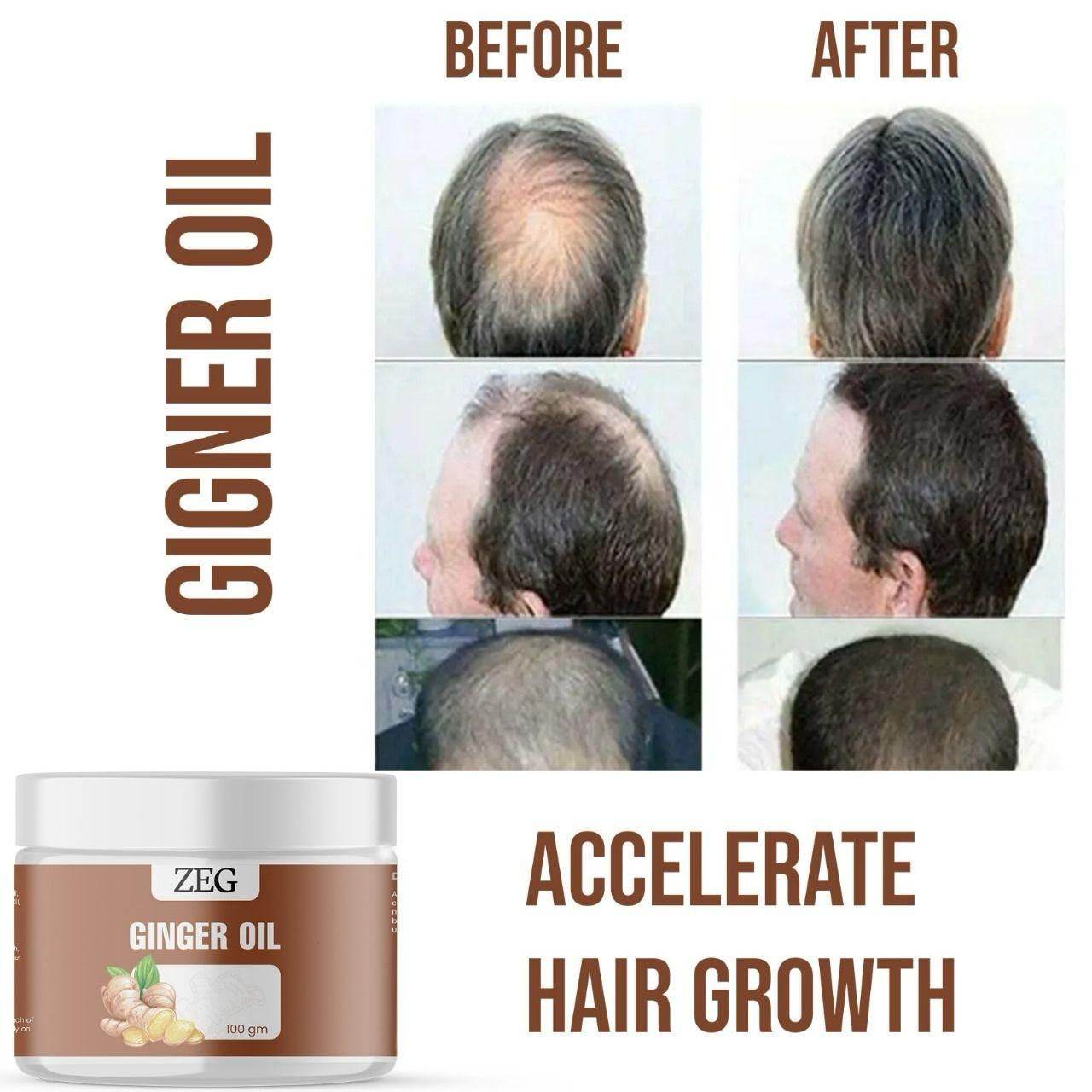 ZEG GINGER OIL 100GM ? 100% Natural Multipurpose Oil for Hair, Skin & Body - NARIX INDIA 