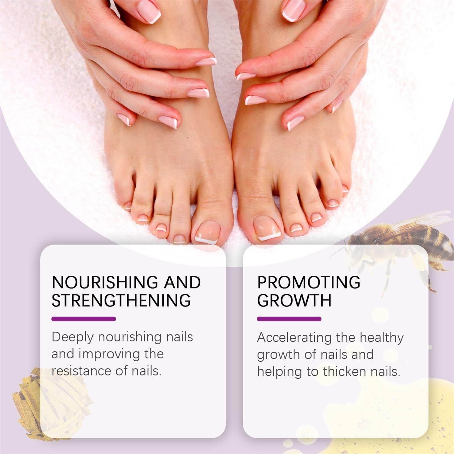 Fungi Free Bee Venom Nail Treatment Solution Serum (15ml) - NARIX INDIA 