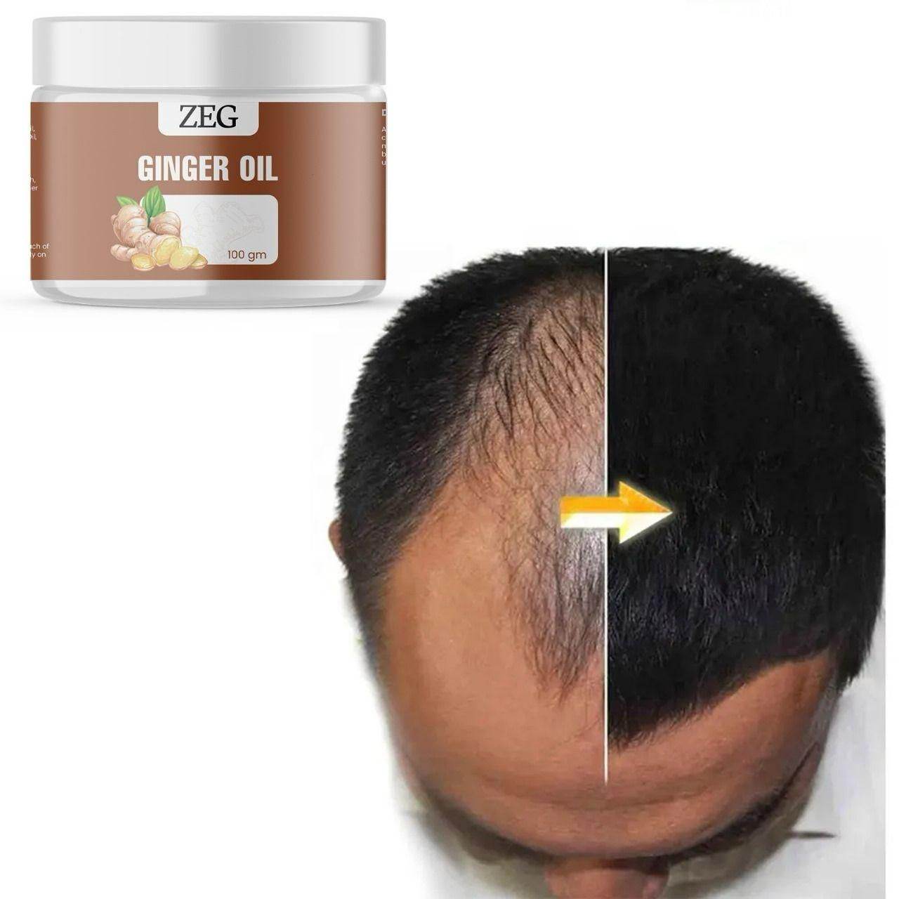 ZEG GINGER OIL 100GM ? 100% Natural Multipurpose Oil for Hair, Skin & Body - NARIX INDIA 