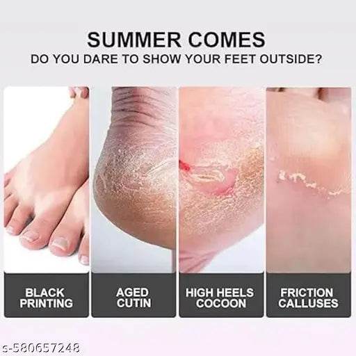 Foot Peeling Mask for Dead Skin Removal – Natural Exfoliating Foot Mask for Dry Feet, Calluses & Cracked Heels (levender foot mask) - NARIX INDIA 