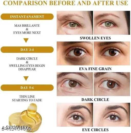 24k Gold Eye Patches for Dark Circles | 60 Pcs Eye Cooling Gel Pads | Hydrogel Eye Patch Mask with Collagen for Relaxing Eyes, Reducing Puffiness & Wrinkles - NARIX INDIA 